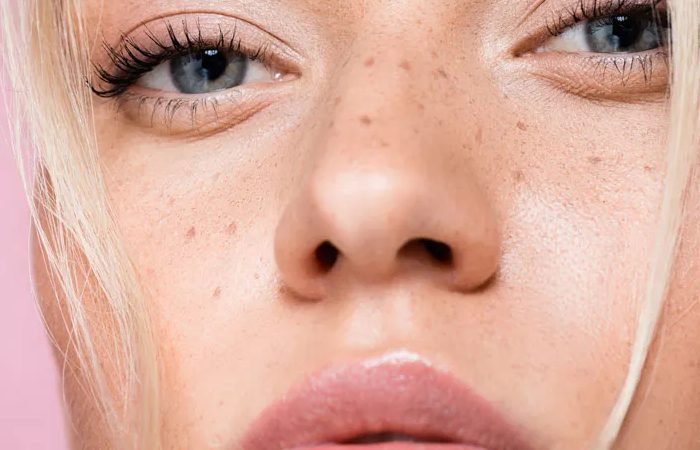 Artificial freckles